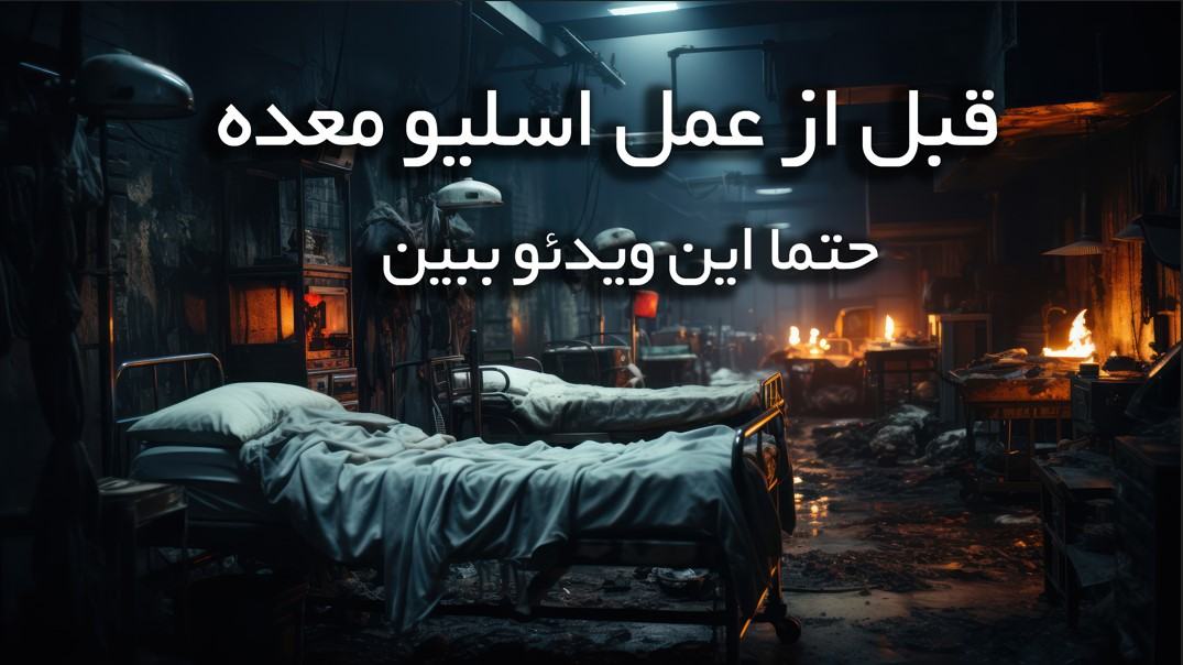 عمل اسلیو معده