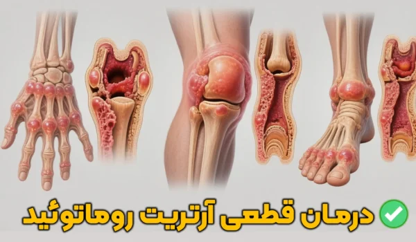 درمان قطعی آرتریت روماتوئید