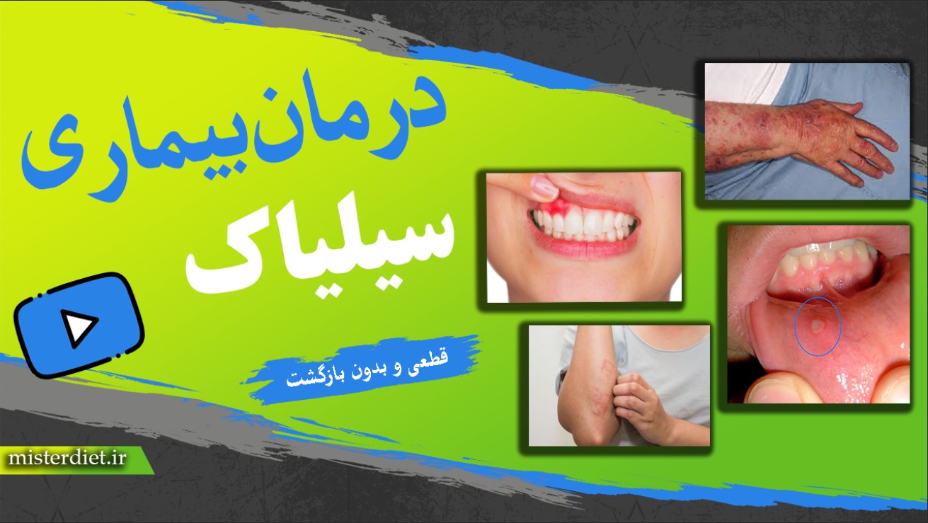درمان بیماری سیلیاک