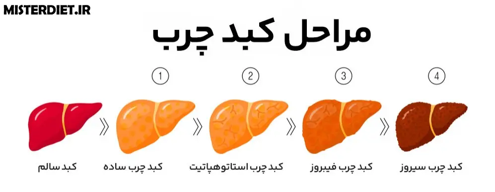 چهر مرحله تبدیل کبد سالم به کبدچرب سیروز