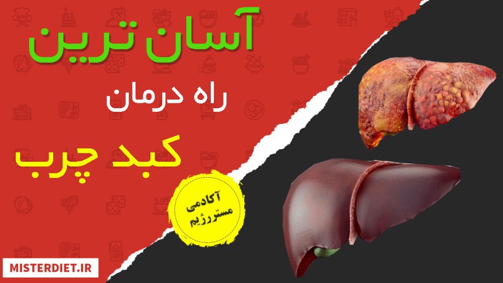 راه درمان کبدچرب