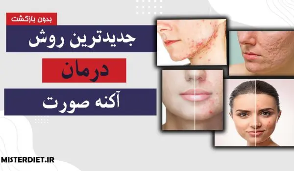 از بین بردن آکنه و جای جوش صورت