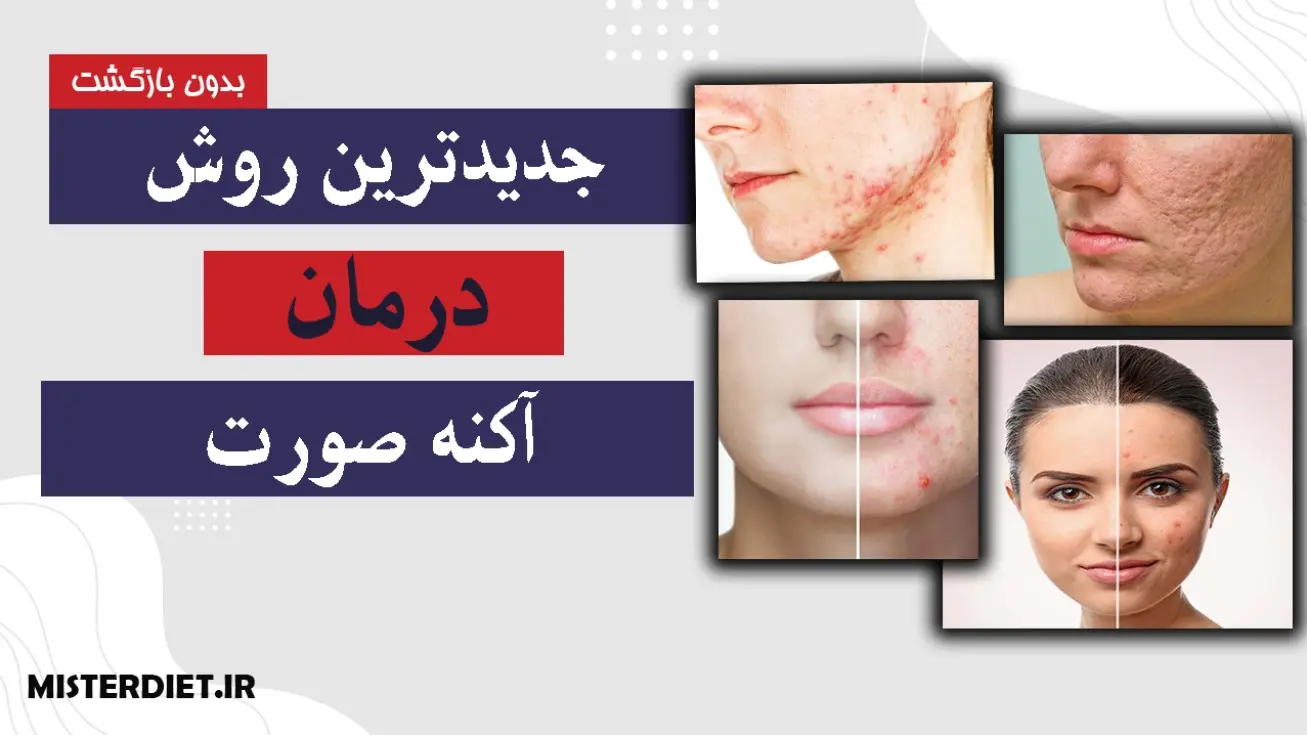 از بین بردن آکنه و جای جوش صورت