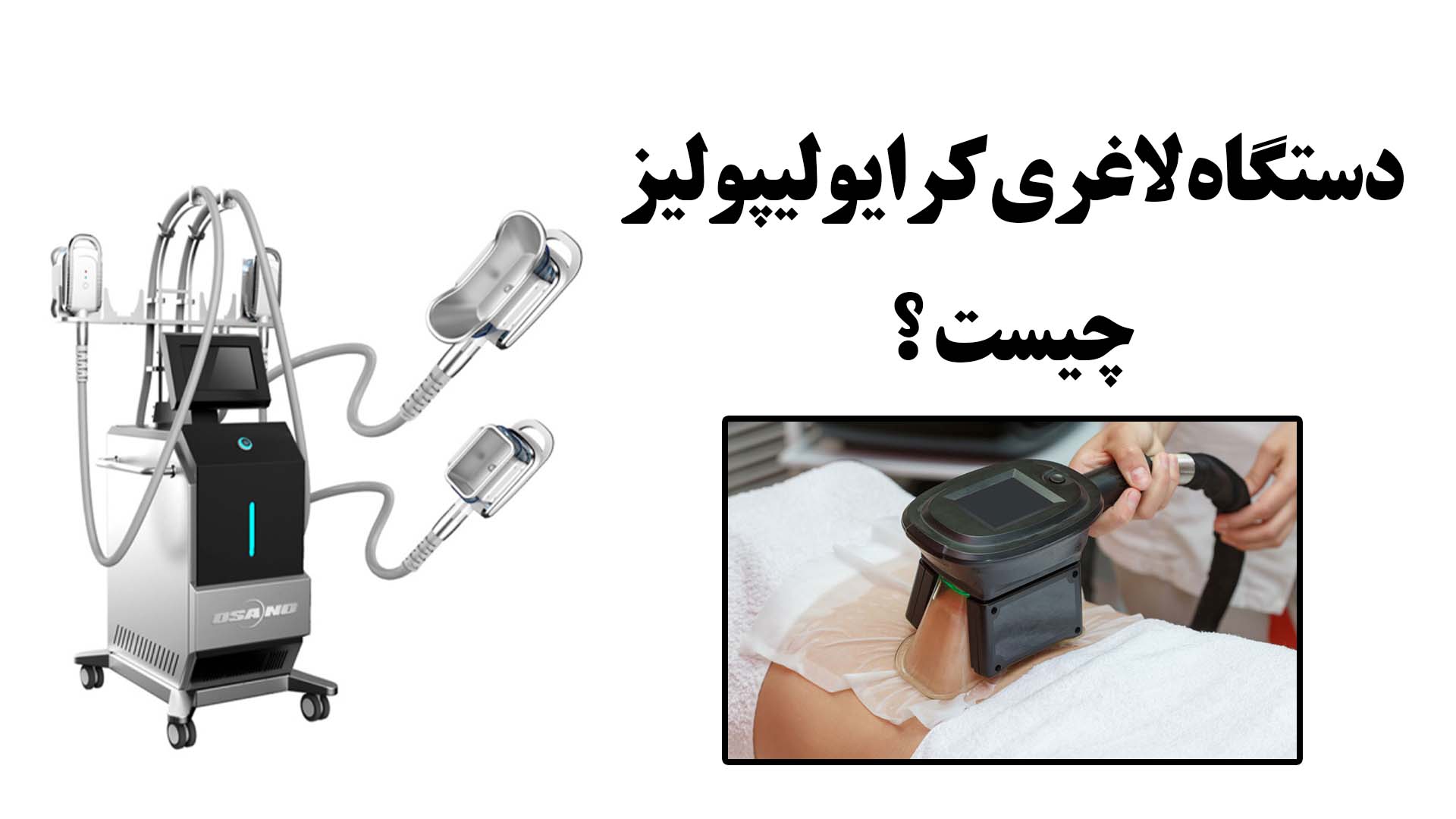 دستگاه لاغری کرایولیپولیز