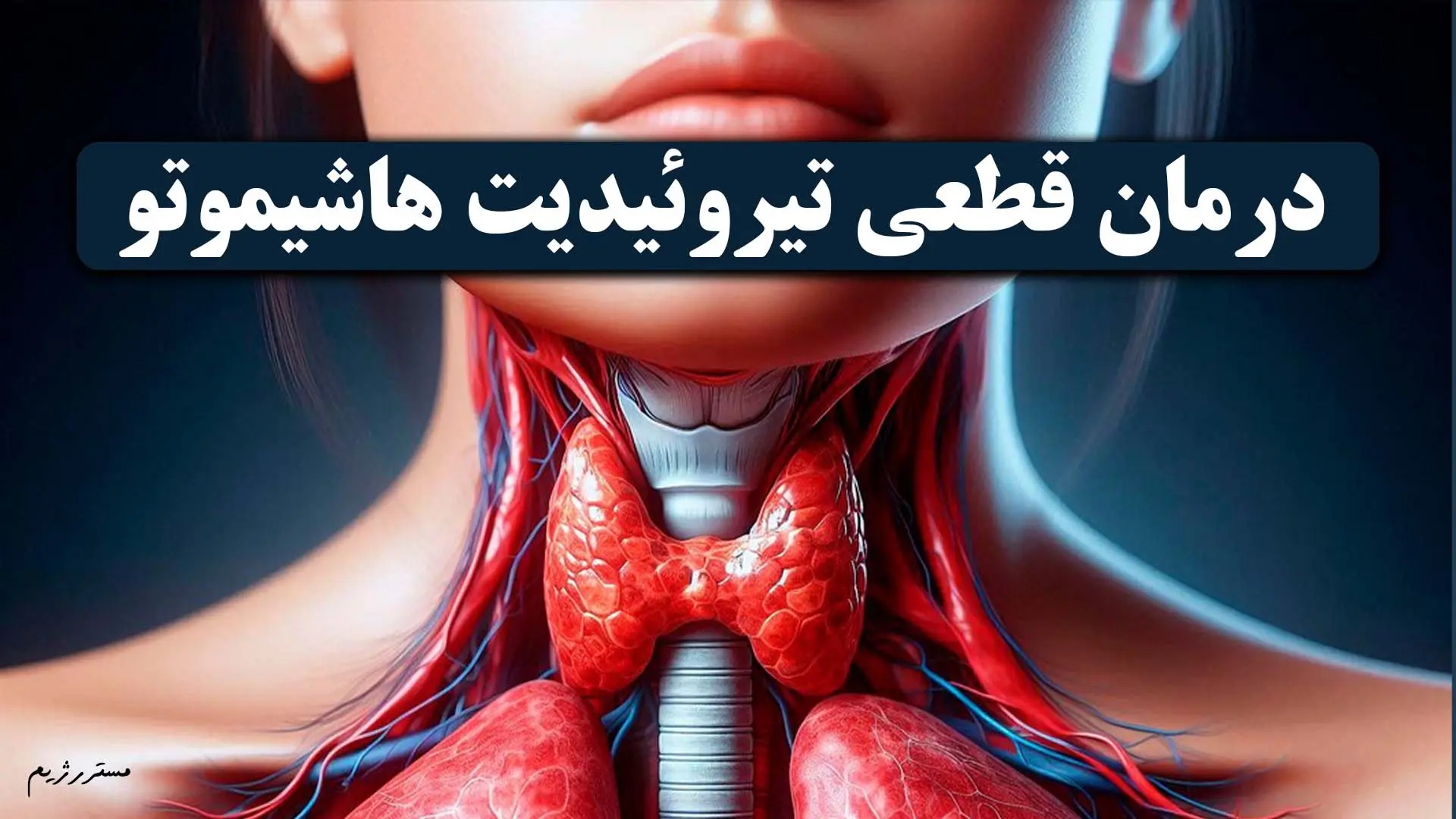 تیروئیدیت هاشیموتو