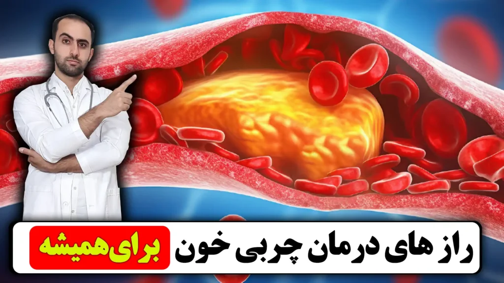 درمان چربی خون