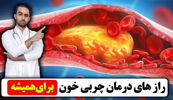 درمان چربی خون