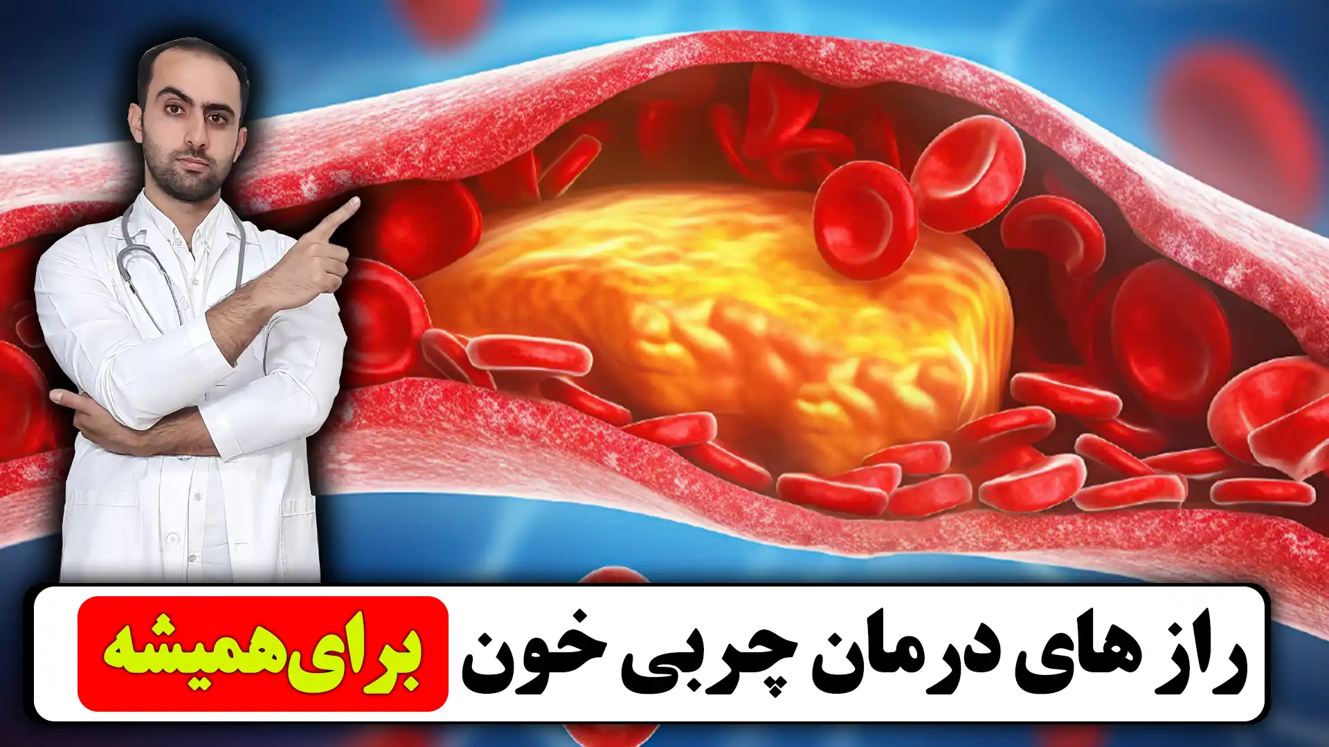 درمان چربی خون