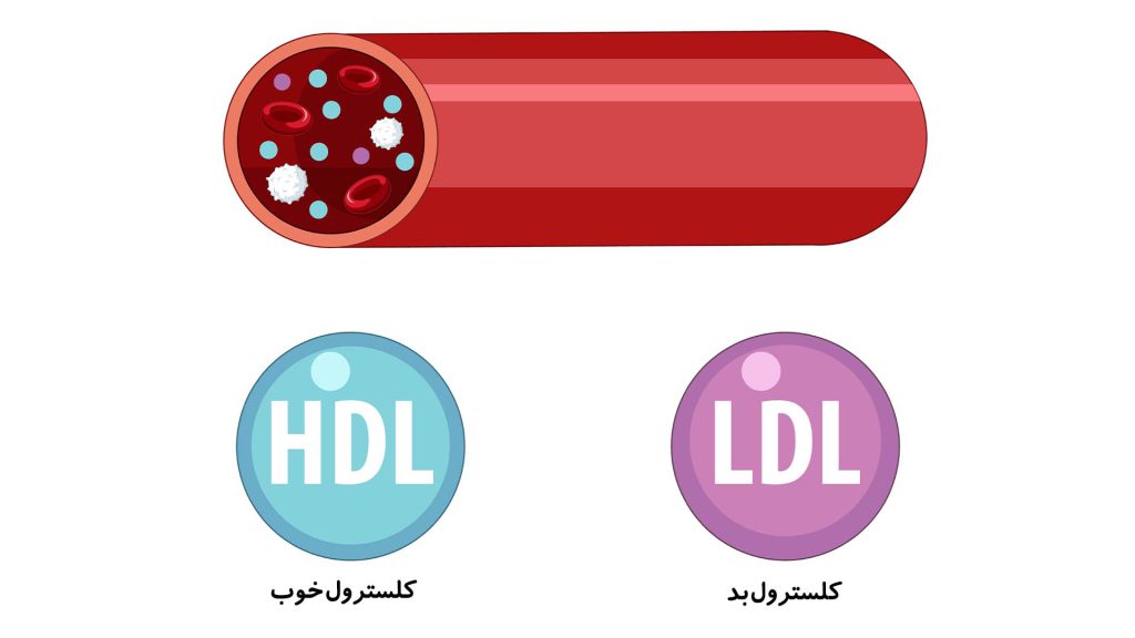 تصویر ال دی ال خوب و تصویر ال دی ال بد