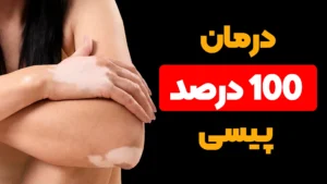 درمان صددرصد پیسی