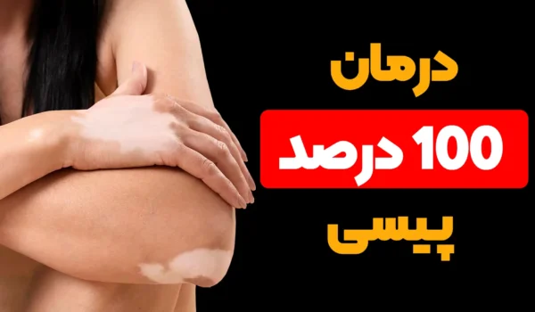 درمان صددرصد پیسی