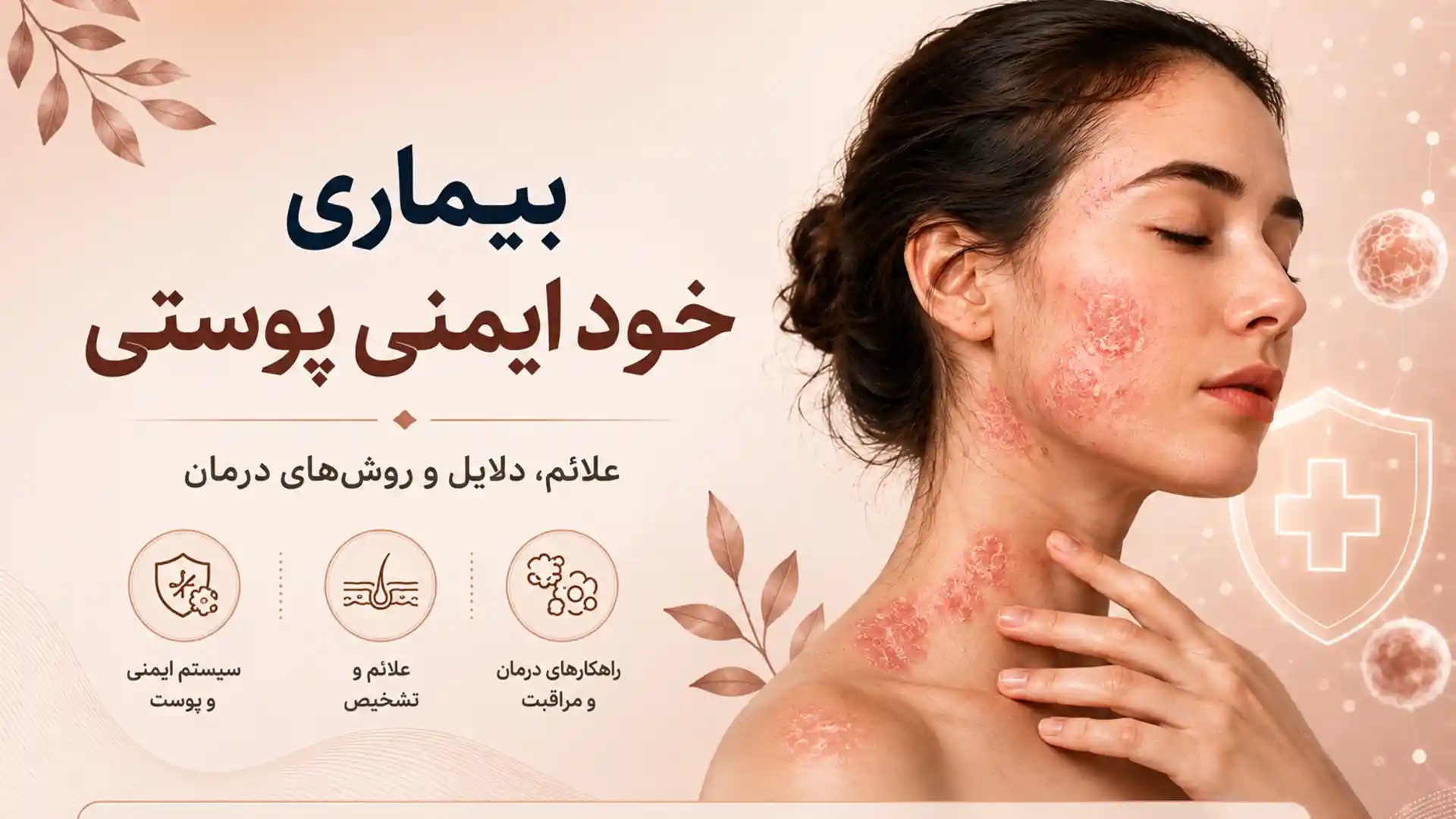 بیماری خودایمنی پوستی